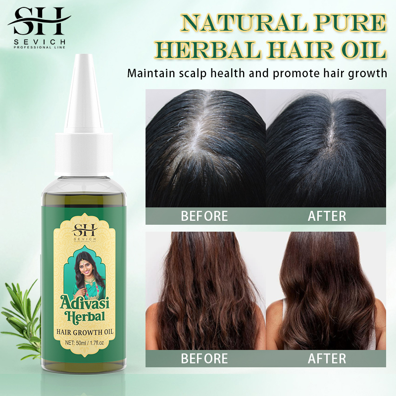 Ayurvedic Hair Growth Oil Adiv - Ayurvedic & Herbal Wellness Kits review and price